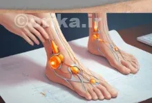 نوروپاتی چیست و چرا اعصاب دچار آسیب می‌شوند؟