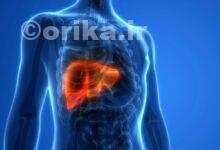 هپاتیت چیست؟