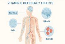 کمبود ویتامین‌های گروه B