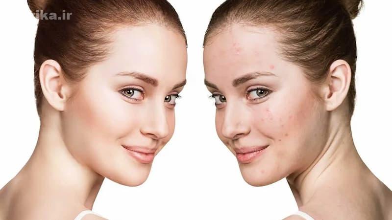 چند بار در هفته فیشیال کنیم؟