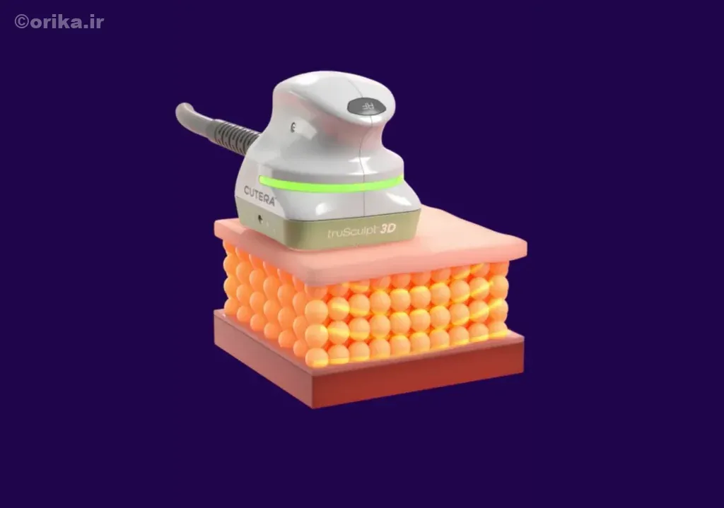 بادی‌تایت سه‌بعدی (3D BodyTite Sculpting)