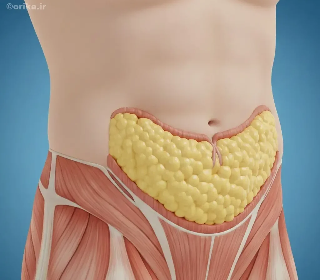 دلایل اصلی تجمع چربی زیر شکم در خانم‌ها