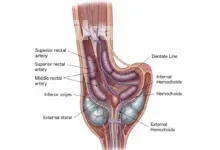 بواسیر چیست و چه علائمی دارد؟