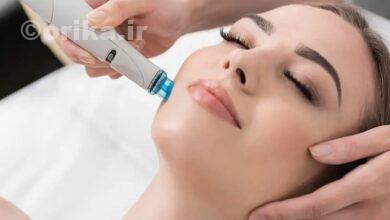 عوارض فیشیال صورت