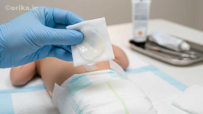 تعویض پوشک بعد از ختنه
