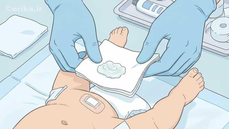 مراقبت‌های اولیه بعد از ختنه نوزاد