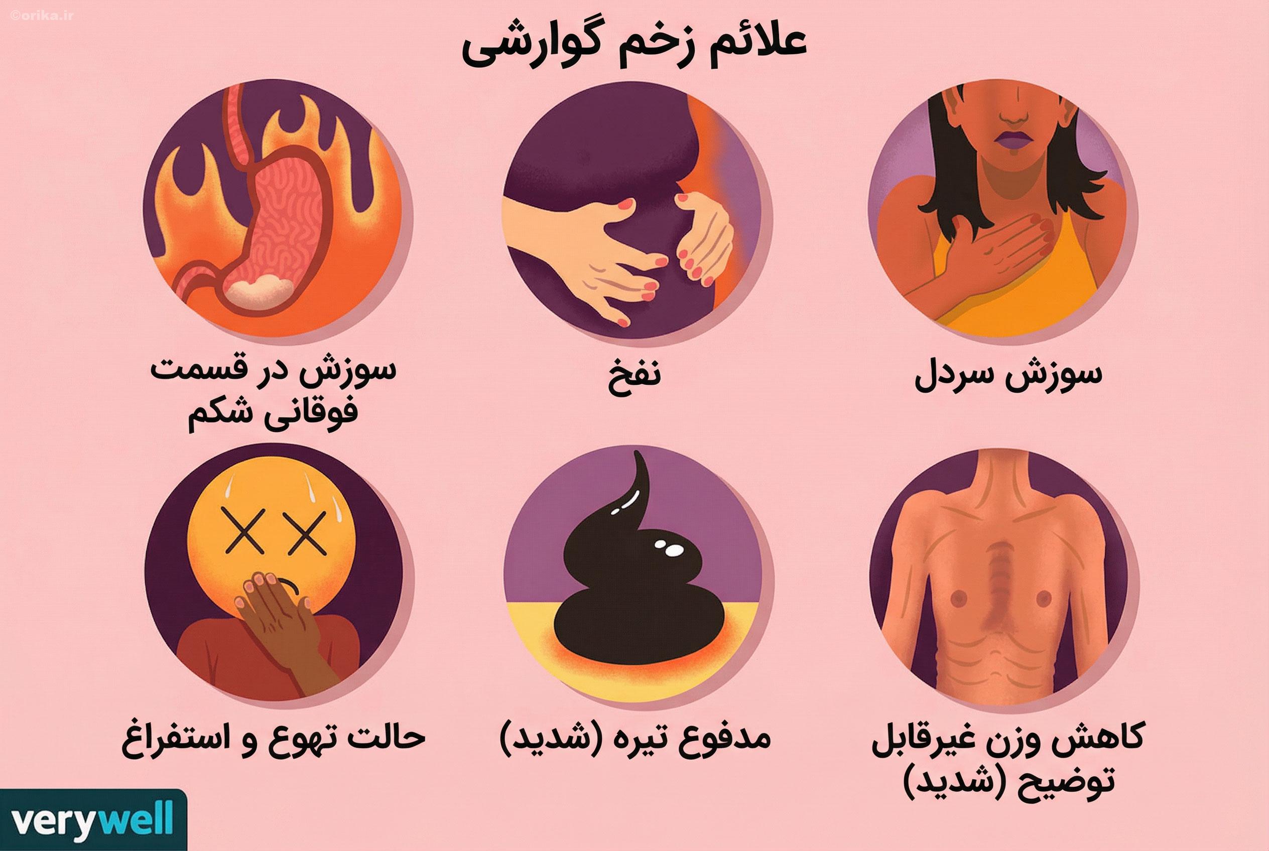 علائم زخم معده